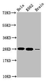 Histone H1.4 Antibody in Western Blot (WB)