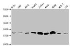 Histone H1.4 Antibody in Western Blot (WB)