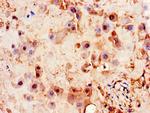 PITX3 Antibody in Immunohistochemistry (Paraffin) (IHC (P))