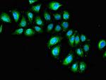 IL1R1 Antibody in Immunocytochemistry (ICC/IF)