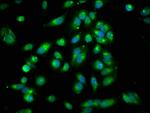 ARHGEF7 Antibody in Immunocytochemistry (ICC/IF)