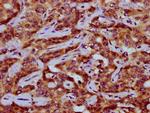 PEX11A Antibody in Immunohistochemistry (Paraffin) (IHC (P))