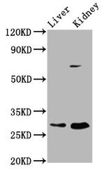 PEX11A Antibody in Western Blot (WB)