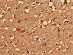 PKA beta Antibody in Immunohistochemistry (Paraffin) (IHC (P))