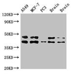 PKA beta Antibody in Western Blot (WB)