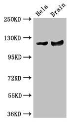 RASA1 Antibody in Western Blot (WB)