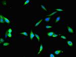 BHMT2 Antibody in Immunocytochemistry (ICC/IF)