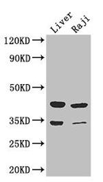 BHMT2 Antibody in Western Blot (WB)