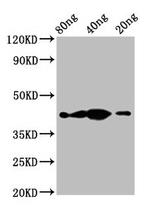 Tyrosine Hydroxylase Antibody in Western Blot (WB)