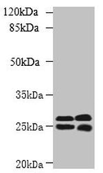 CMBL Antibody in Western Blot (WB)