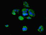 MID2 Antibody in Immunocytochemistry (ICC/IF)