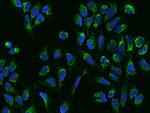 ACOT1 Antibody in Immunocytochemistry (ICC/IF)