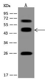 ACOT1 Antibody in Western Blot (WB)