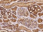 alpha Actinin 4 Antibody in Immunohistochemistry (Paraffin) (IHC (P))