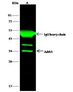 beta-3 Adrenergic Receptor Antibody in Immunoprecipitation (IP)