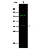 beta-3 Adrenergic Receptor Antibody in Western Blot (WB)