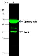 beta-3 Adrenergic Receptor Antibody in Immunoprecipitation (IP)