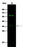 beta-3 Adrenergic Receptor Antibody in Western Blot (WB)