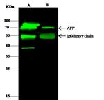 AFP Antibody in Immunoprecipitation (IP)