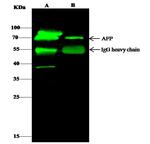 AFP Antibody in Immunoprecipitation (IP)