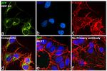 AFP Antibody