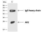 Adenylate Kinase 1 Antibody in Immunoprecipitation (IP)