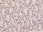 AP2A2 Antibody in Immunohistochemistry (Paraffin) (IHC (P))