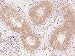 AP2A2 Antibody in Immunohistochemistry (Paraffin) (IHC (P))