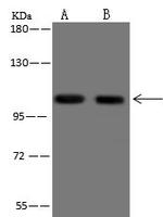 AP2A2 Antibody in Western Blot (WB)