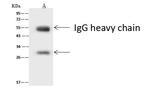 ASCL1 Antibody in Immunoprecipitation (IP)