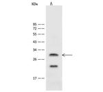 ASCL1 Antibody in Western Blot (WB)