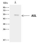 ASL Antibody in Immunoprecipitation (IP)