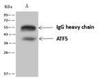 ATF5 Antibody in Immunoprecipitation (IP)