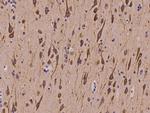 BAP29 Antibody in Immunohistochemistry (Paraffin) (IHC (P))