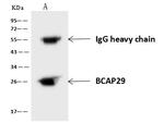 BAP29 Antibody in Immunoprecipitation (IP)