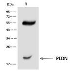 Pallidin Antibody in Immunoprecipitation (IP)