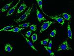 C1QBP Antibody in Immunocytochemistry (ICC/IF)