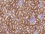 C1QBP Antibody in Immunohistochemistry (Paraffin) (IHC (P))