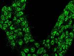 Calbindin Antibody in Immunocytochemistry (ICC/IF)