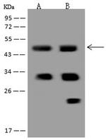 Calsequestrin 2 Antibody in Western Blot (WB)