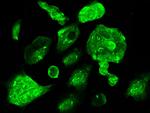 CBF beta Antibody in Immunocytochemistry (ICC/IF)