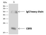 CBF beta Antibody in Immunoprecipitation (IP)