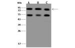 CD2AP Antibody in Western Blot (WB)