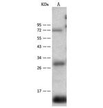 CD59 Antibody in Western Blot (WB)