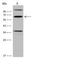 CDYL Antibody in Western Blot (WB)