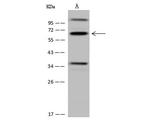 CDYL Antibody in Western Blot (WB)