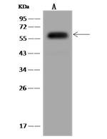 NARFL Antibody in Western Blot (WB)