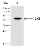 Creatine Kinase BB Antibody in Immunoprecipitation (IP)