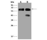 CLCC1 Antibody in Western Blot (WB)