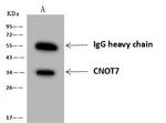 CNOT7 Antibody in Immunoprecipitation (IP)